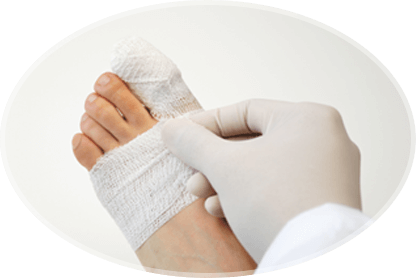 feet wound care